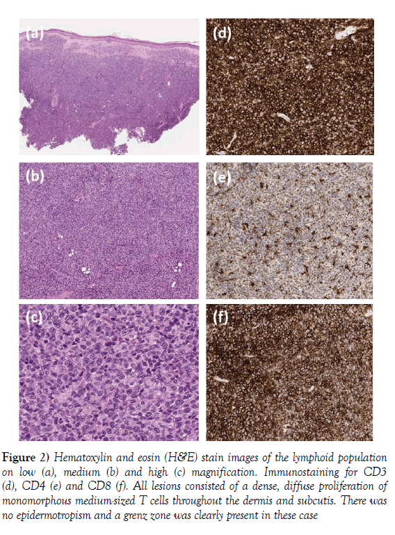 dermatopathology-stain-images