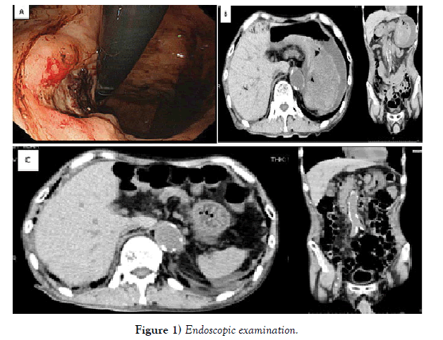 hepato-gastroenterology-Endoscopic