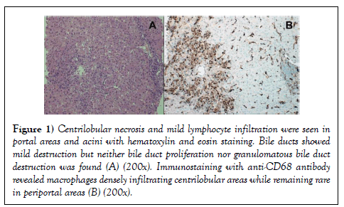 hepatogastroenterology-necrosis