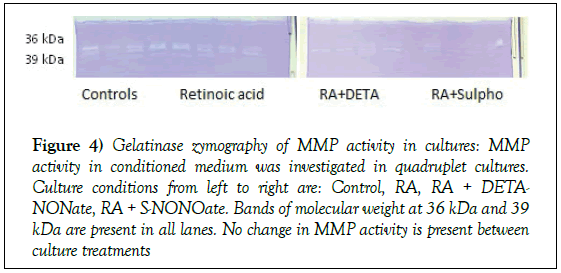 histology-histopathology-research-gelatinase-zymography-quadruplet