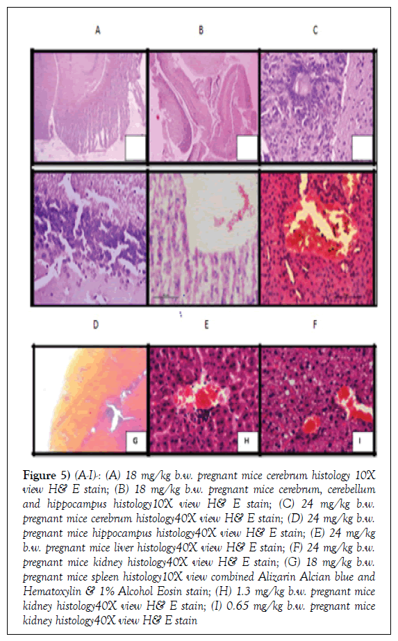 histology-histopathology-research-pregnant-mice-cerebrum