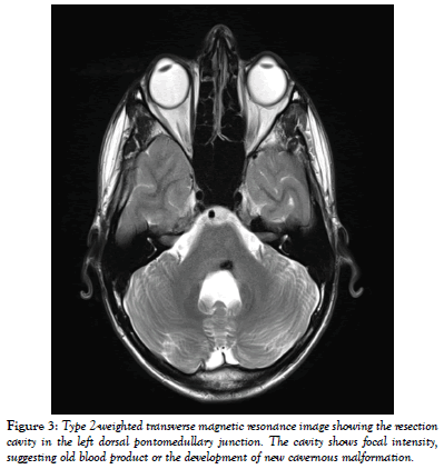 international-journal-anatomical-variations-development