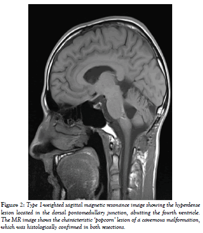 international-journal-anatomical-variations-resonance