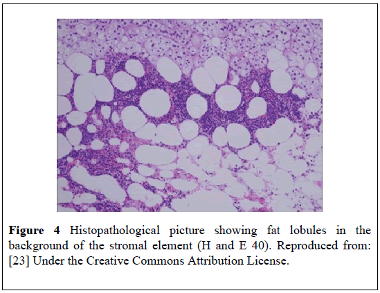 pulsus-journal-surgical-research-Histopathological