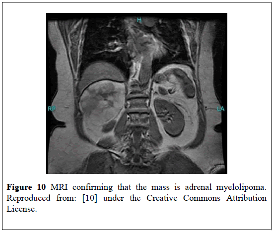 pulsus-journal-surgical-research-MRI-confirming