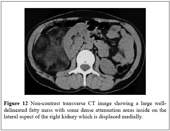 pulsus-journal-surgical-research-Non-contrast