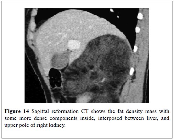 pulsus-journal-surgical-research-Sagittal-reformation