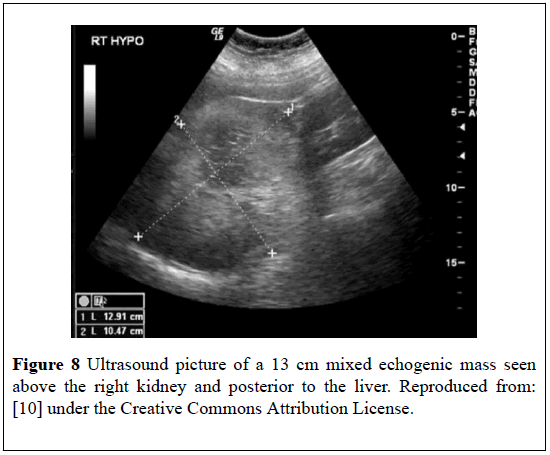 pulsus-journal-surgical-research-Ultrasound-picture