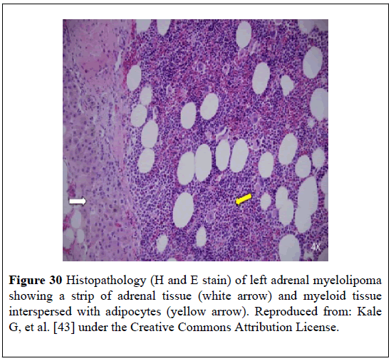 pulsus-journal-surgical-research-adipocytes