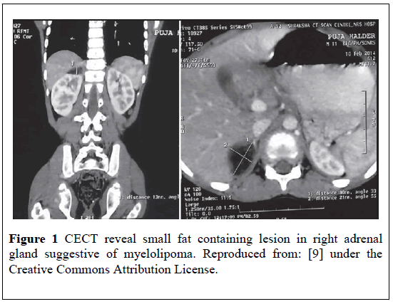 pulsus-journal-surgical-research-fat-containing