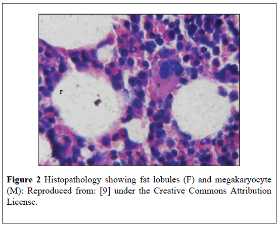 pulsus-journal-surgical-research-fat-lobules