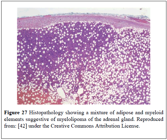 pulsus-journal-surgical-research-myeloid-elements