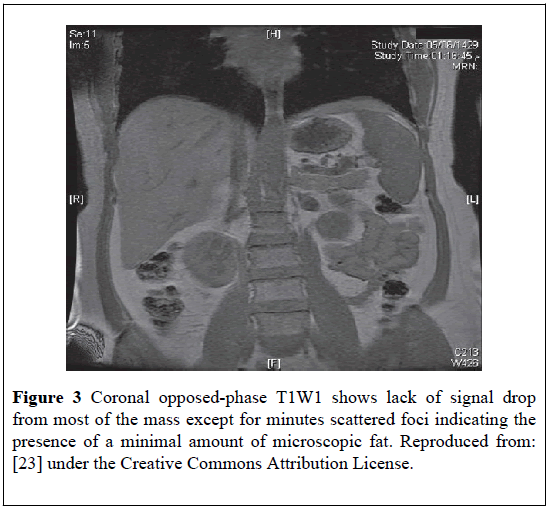 pulsus-journal-surgical-research-opposed-phase