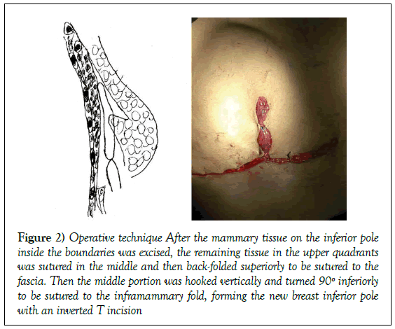 surgery-case-report-Operative-technique