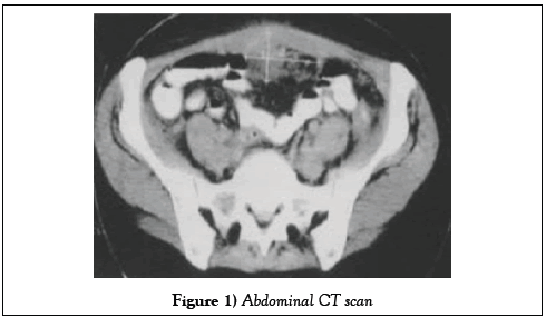 surgery-case-report-abdominal