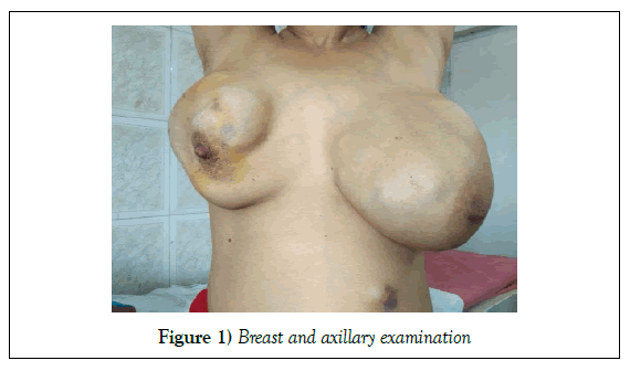 surgery-case-report-axillary-examination