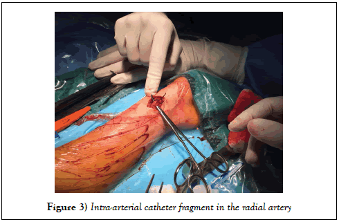 surgery-case-report-fragment