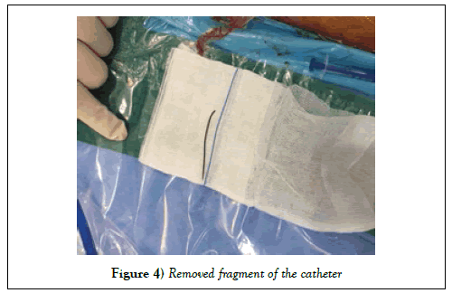 surgery-case-report-fragment