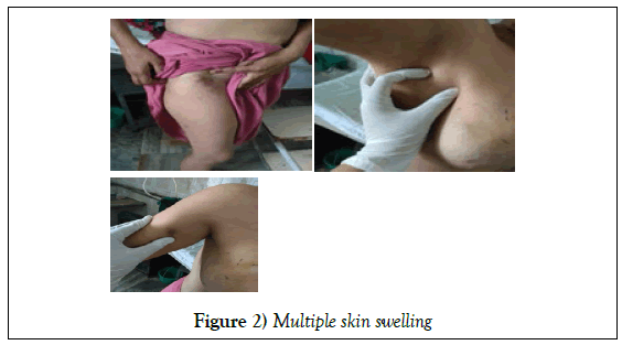 surgery-case-report-skin-swelling